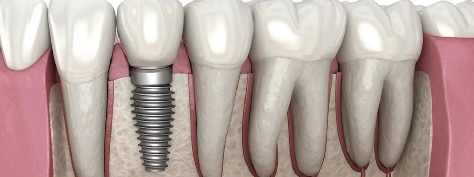 dental
