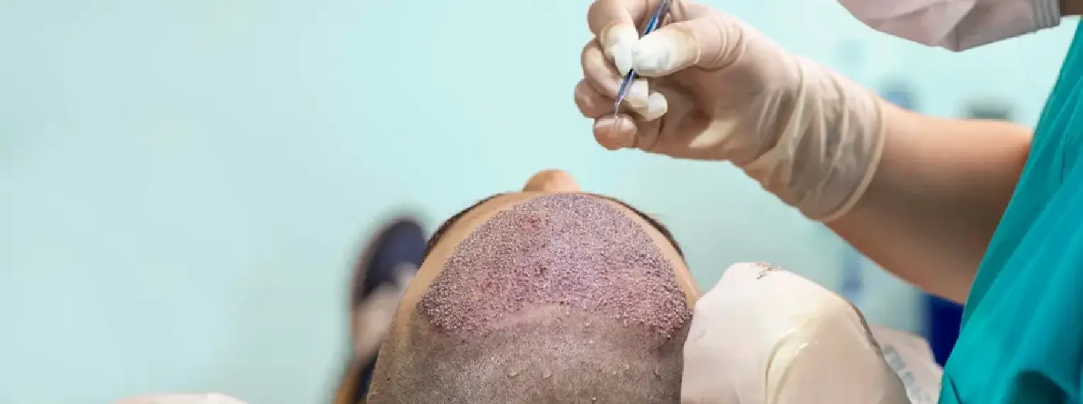 hair 1